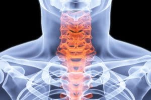 Which Neck Injuries May Require Surgery?